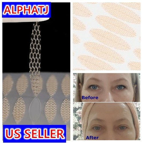240 eyelid lift - lace, strips